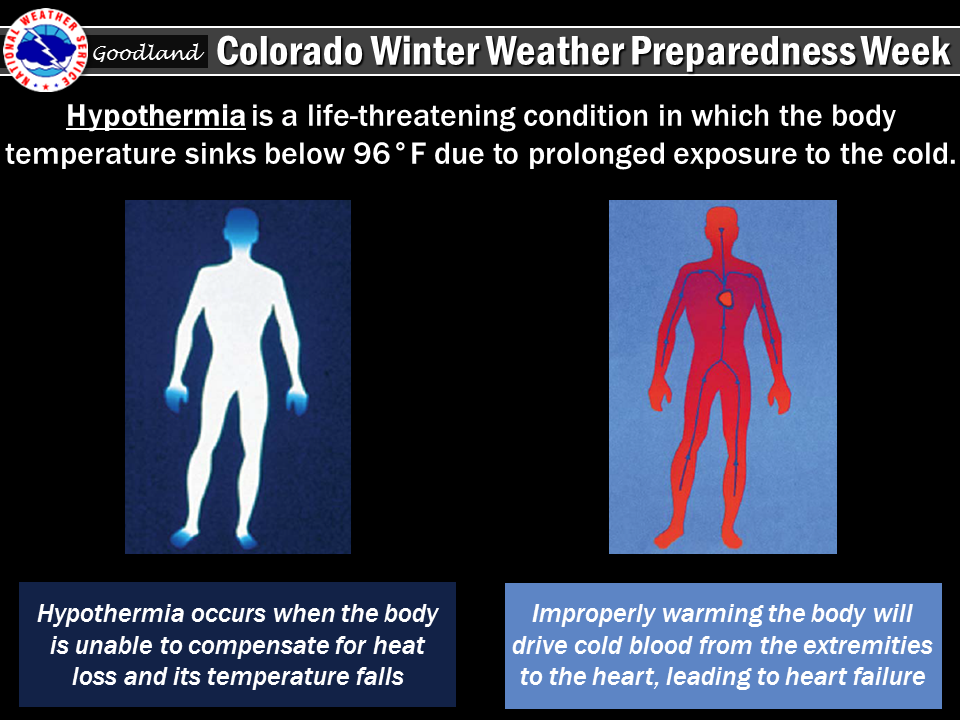 Hypothermia